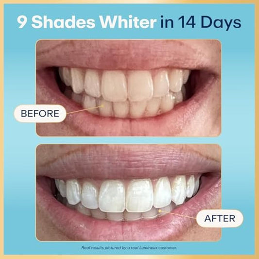 Lumineux Teeth Whitening Strips - 21 Treatments (3 Months) - Peroxide Free - Enamel Safe for Whiter Teeth - Whitening Without The Sensitivity - Dentist Formulated - Sensitivity