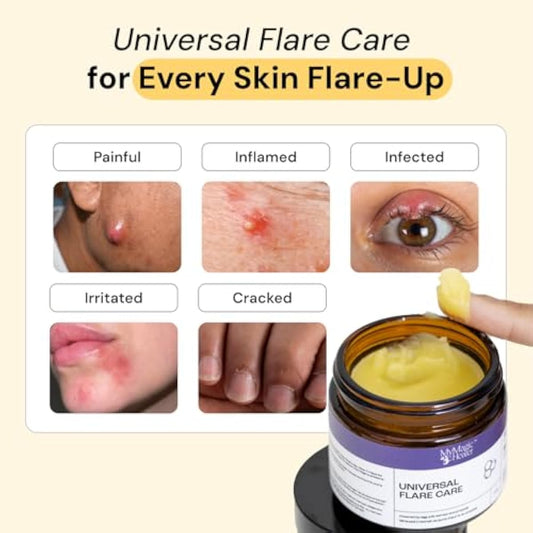 MyMagicHealer Universal Flare Care – Multi-Purpose Solution | Skin Flare-Ups - Hidradenitis Suppurativa, Folliculitis, Boils, Cysts | Anti-Chafing | Irritated Skin Relief w/Propolis & Egg Yolk 4 oz