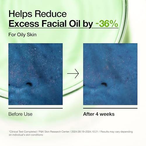 Anua Azelaic Acid 10 Hyaluron Redness Soothing Serum, Facial Serum for Blemish-Prone & Oily-Prone Skin, Lightweight & Hydrating Blemish Care, Hyaluronic Acid, Korean Skincare, 1.01 fl oz.