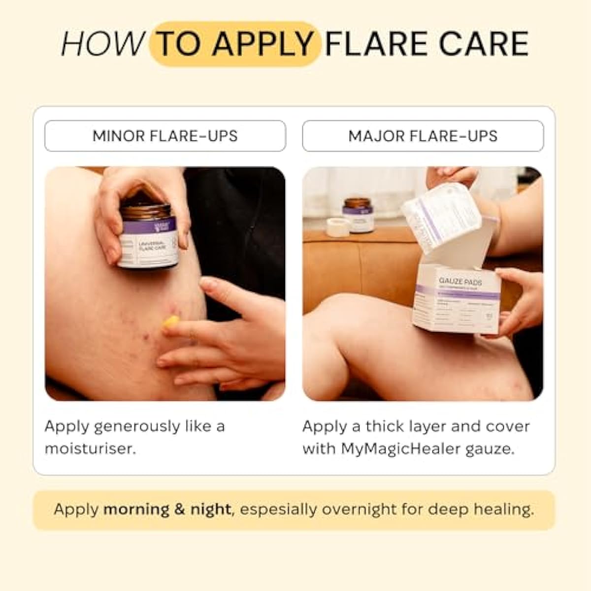 MyMagicHealer Universal Flare Care – Multi-Purpose Solution | Skin Flare-Ups - Hidradenitis Suppurativa, Folliculitis, Boils, Cysts | Anti-Chafing | Irritated Skin Relief w/Propolis & Egg Yolk 4 oz
