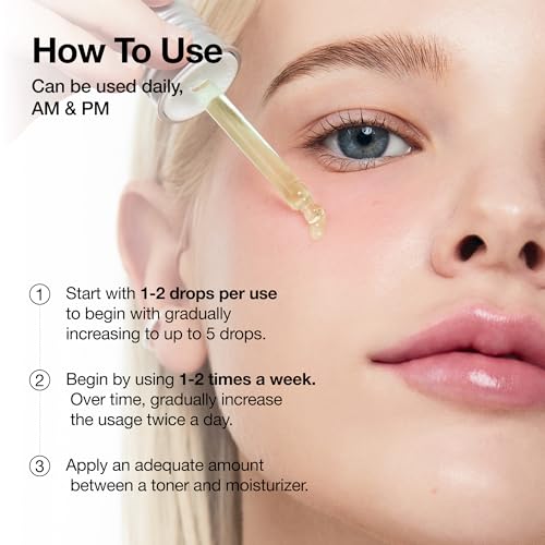 Anua Azelaic Acid 10 Hyaluron Redness Soothing Serum, Facial Serum for Blemish-Prone & Oily-Prone Skin, Lightweight & Hydrating Blemish Care, Hyaluronic Acid, Korean Skincare, 1.01 fl oz.