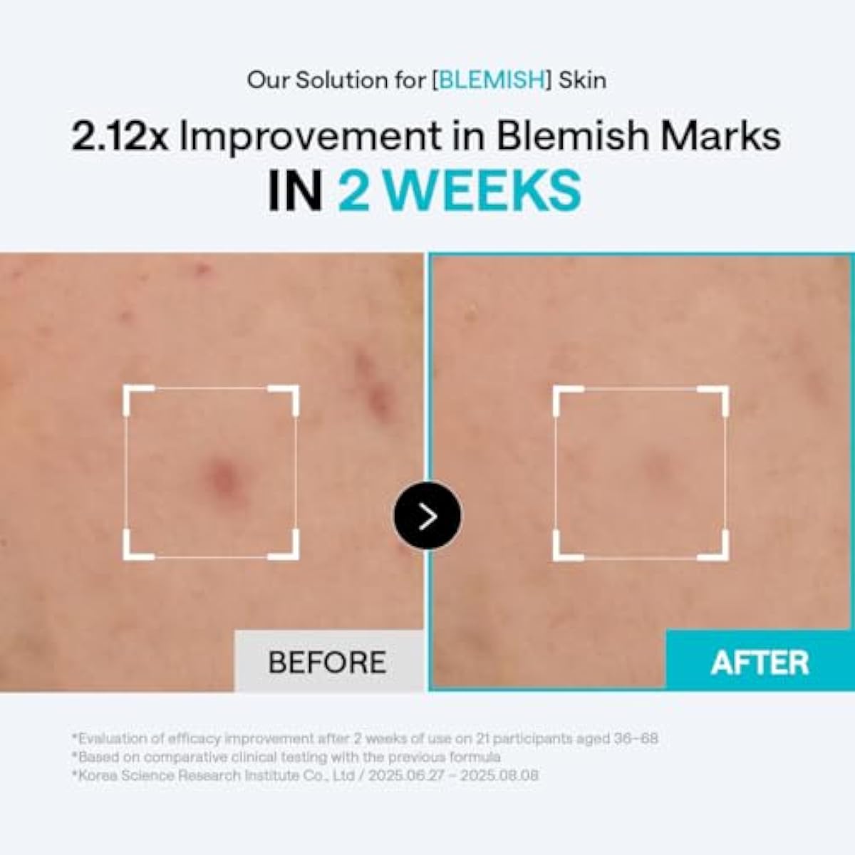 MEDIHEAL Toner Pads 100 Count - Madecassoside Blemish Care Toner Pad with Centella Asiatica - Improves Uneven Skin Tone & Deep Hydration - Vegan Hypoallergenic Face Gauze, Korean Skin Care
