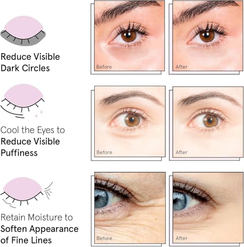 grace & stella Award Winning Under Eye Mask - Birthday Gifts for Women - Gel Eye Patches for Dark Circles, Puffy Eyes, Undereye Bags - Gifts for Mom - Travel Essentials - Vegan (24 Pairs, Gold)